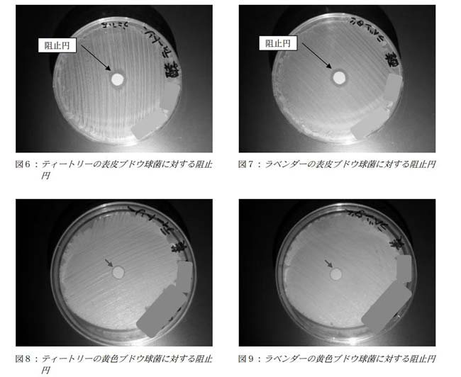 ティートリーとラベンダー精油の抗菌効果