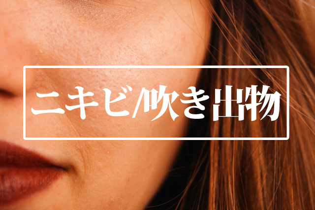 ニキビ　アロマレシピ　アロマオイル